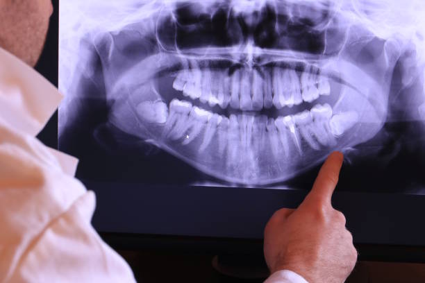 Best Emergency Dental Filling Replacement  in Fairfield Harbour, NC